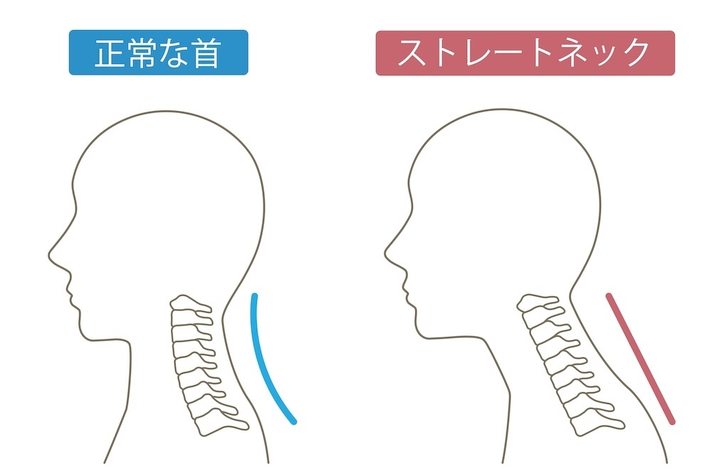 頸椎のイメージ画像