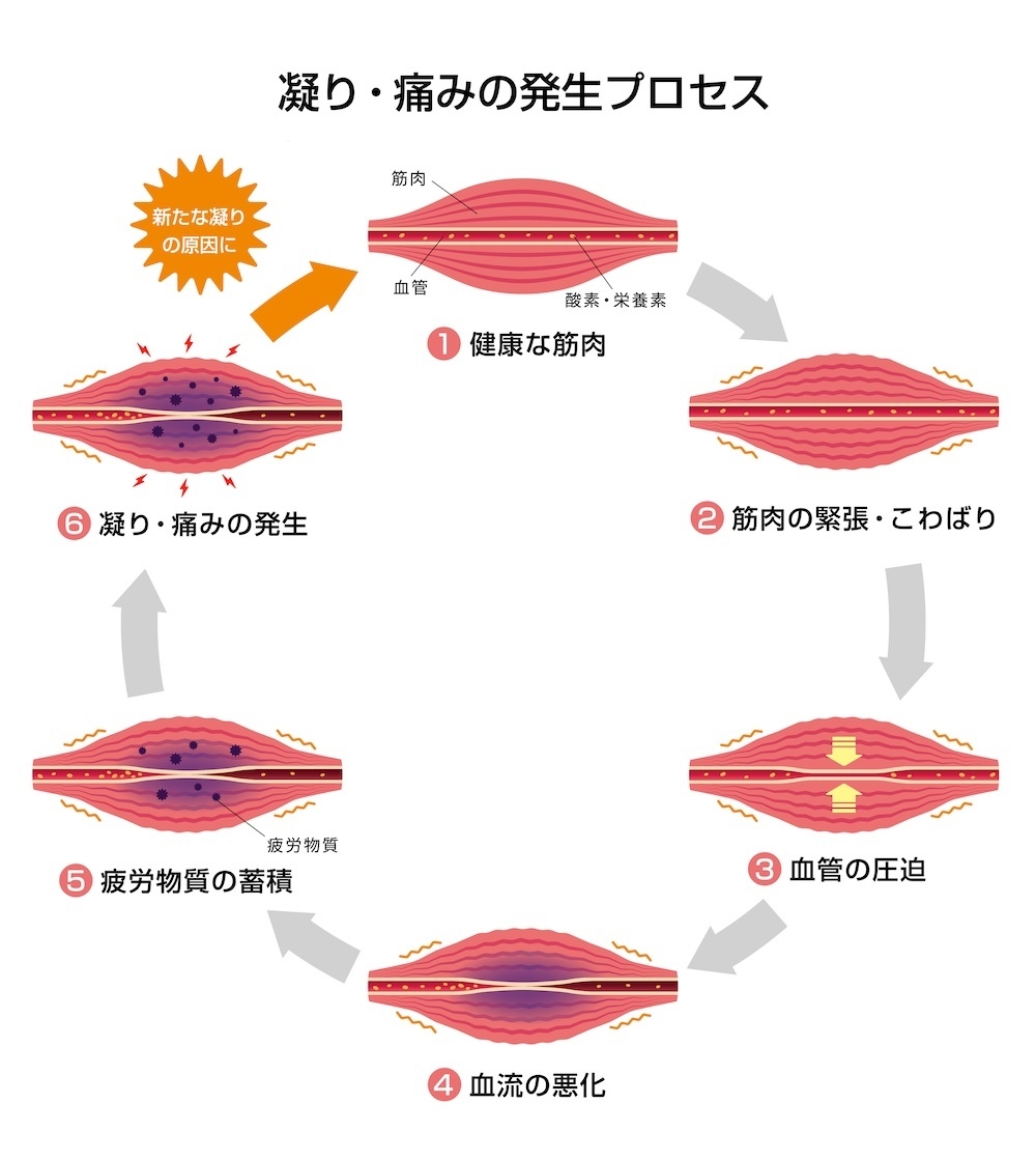 頸椎のイメージ画像