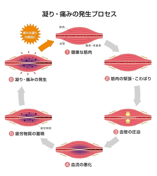 頸椎のイメージ画像