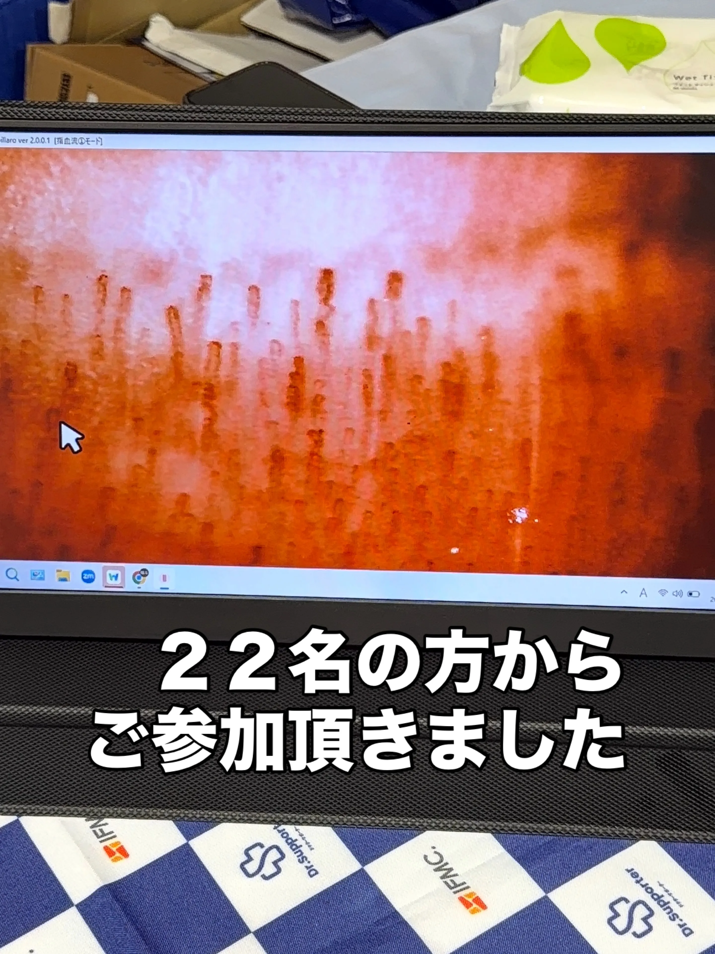 梨の日に見直したい夏の水分補給|むくみ対策にもおすすめの旬の...